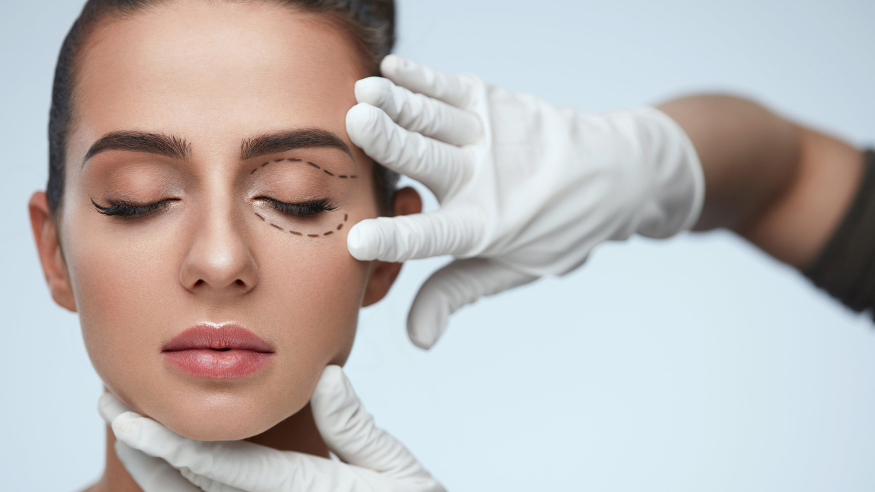 Blefaroplastía o cirugía estética de párpados
