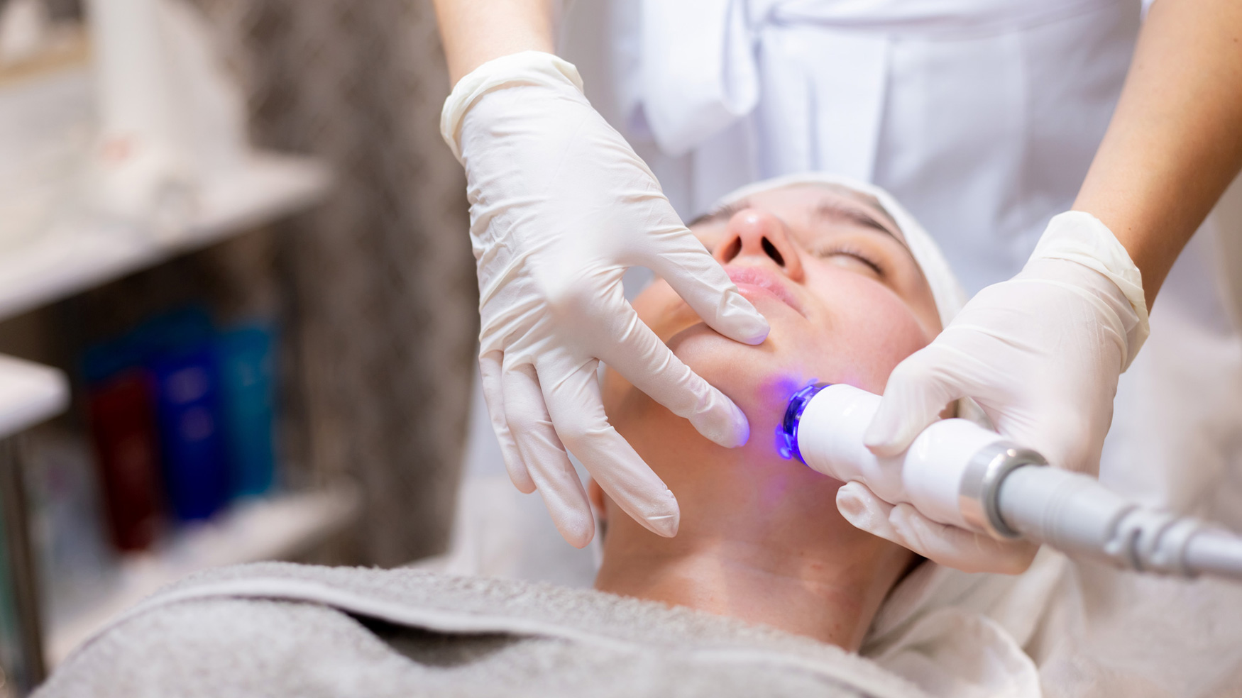 Top 5 de tratamientos estéticos para rejuvenecer la piel
